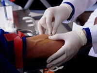 B12 Vitamini Testi Nasıl Yapılır?